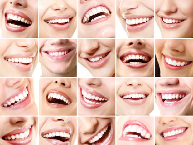 03sorrisoperfeito