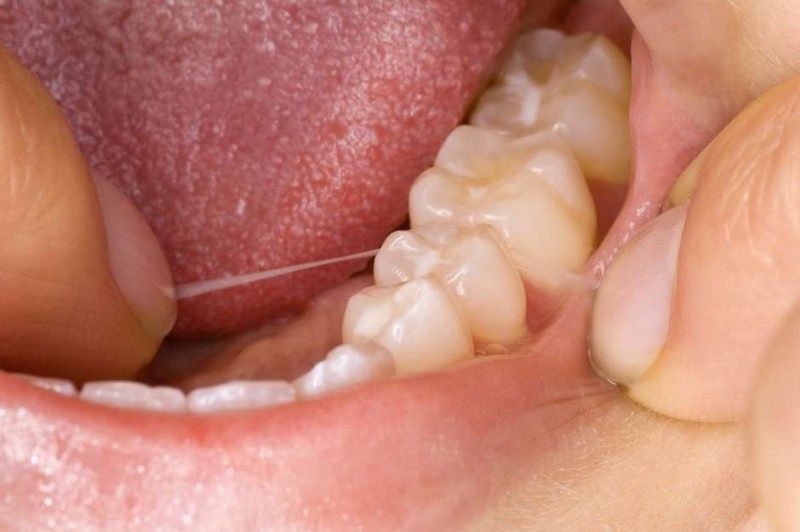saudebucalfiodental